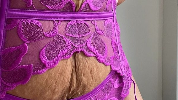Asda lingerie model with stretchmarks