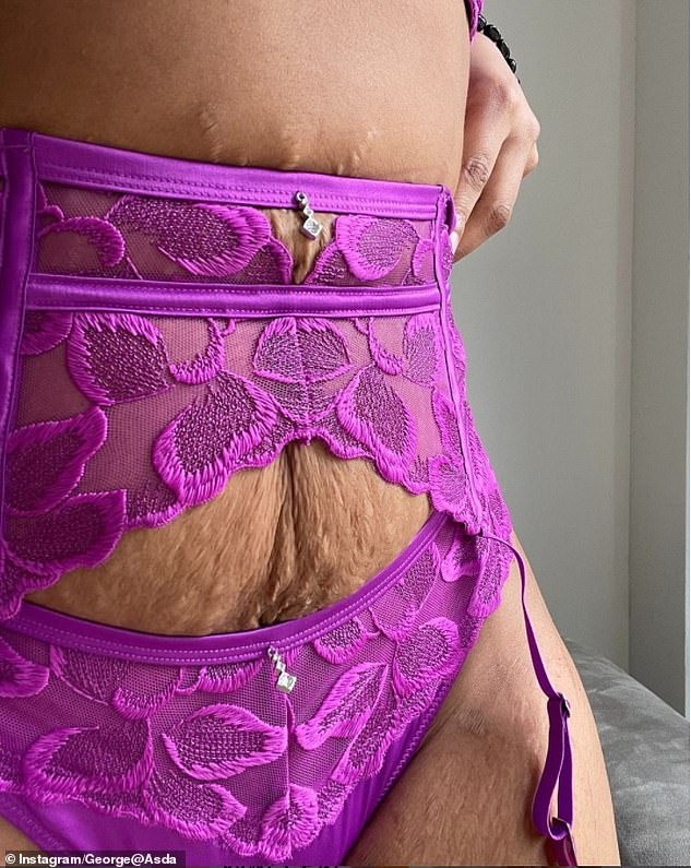 Asda lingerie model with stretchmarks